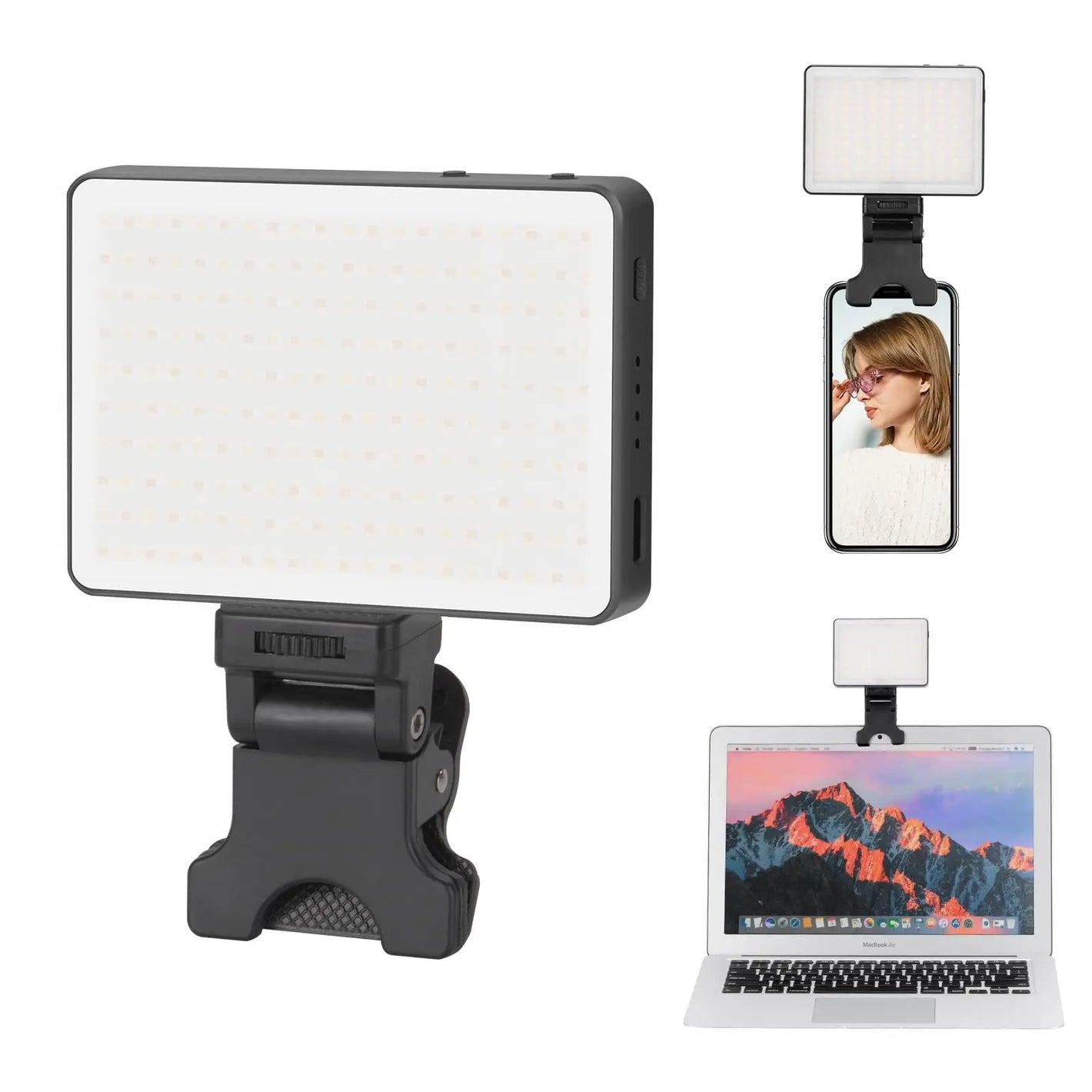 Portable Dental Photo Light
