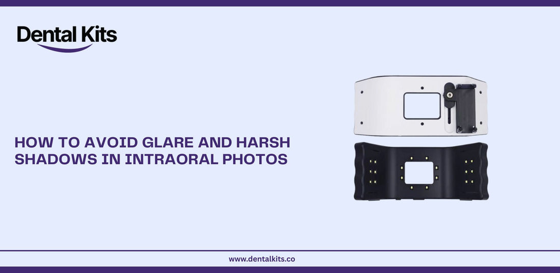 How to Avoid Glare and Harsh Shadows in Intraoral Photos