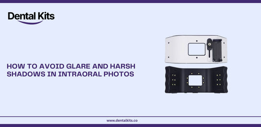 How to Avoid Glare and Harsh Shadows in Intraoral Photos