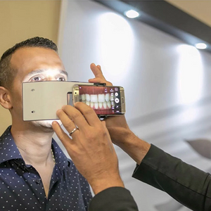 Dental Photography Light