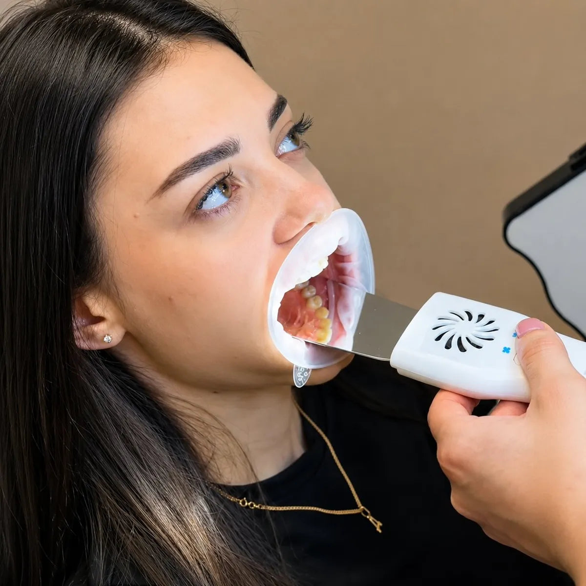 Anti-fog mirror reflecting a buccal view of a patient's teeth.