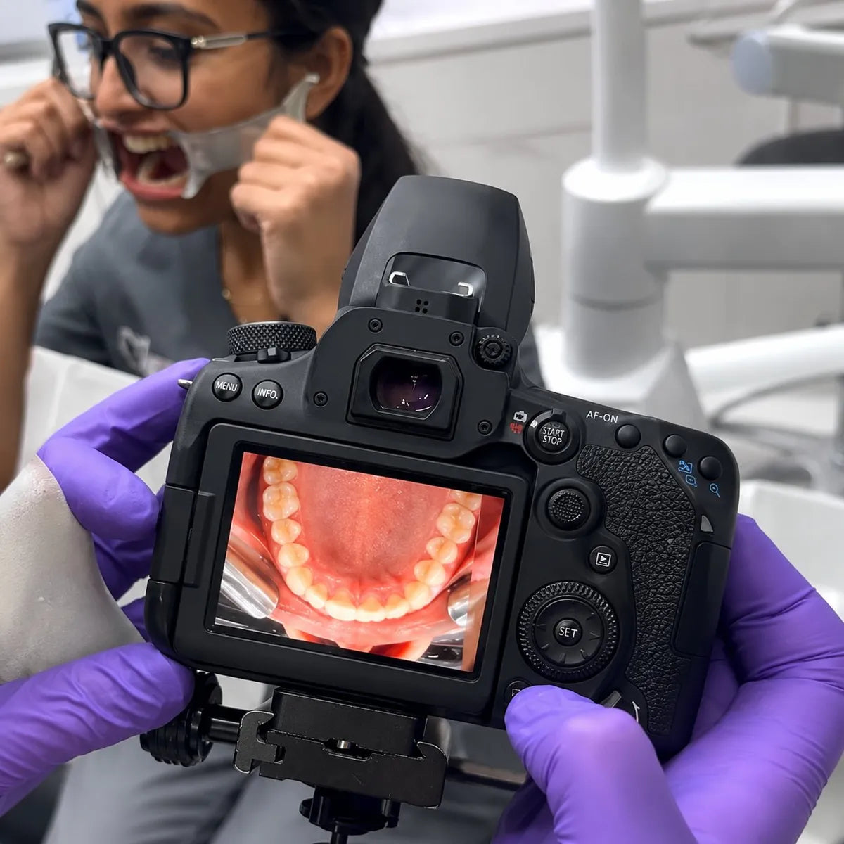 dental photography DSLR screen showing an occlusal photo taken with the anti-fog mirror.