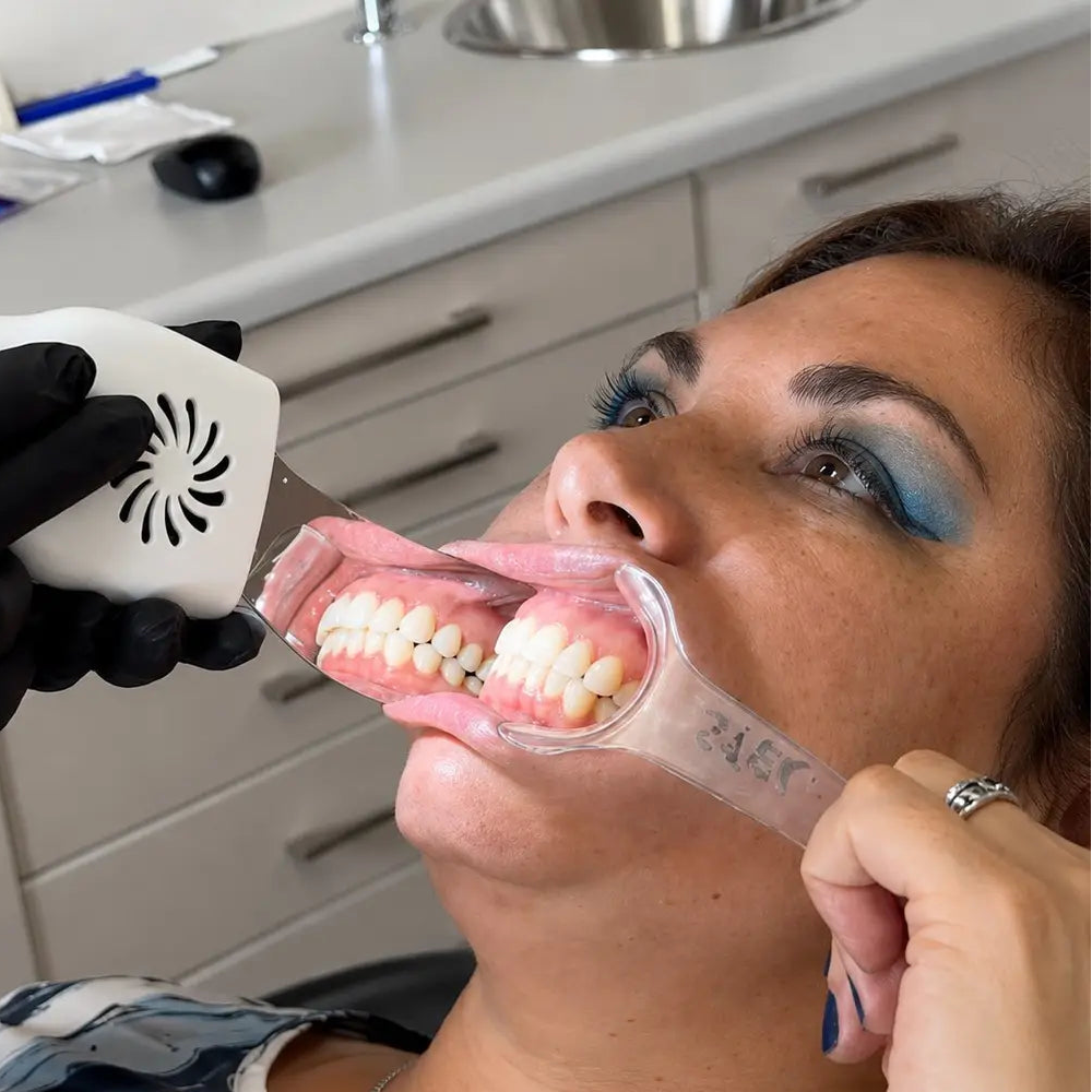Anti-fog mirror used to photograph front teeth with a retractor.