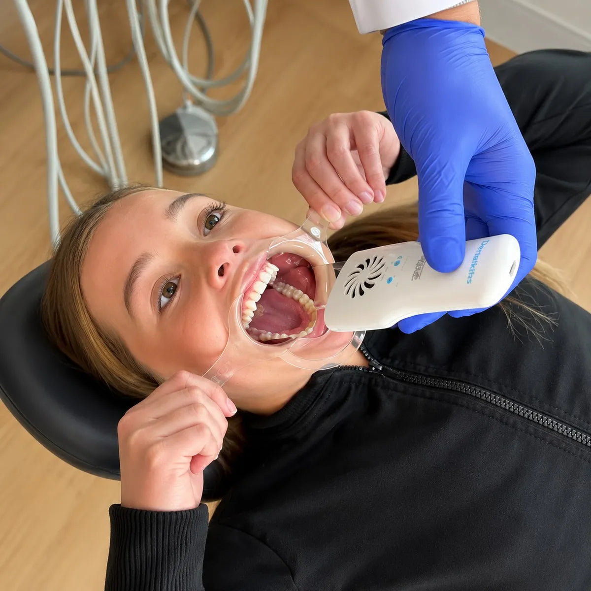 Anti-fog mirror inside a patient's mouth for intraoral photography.