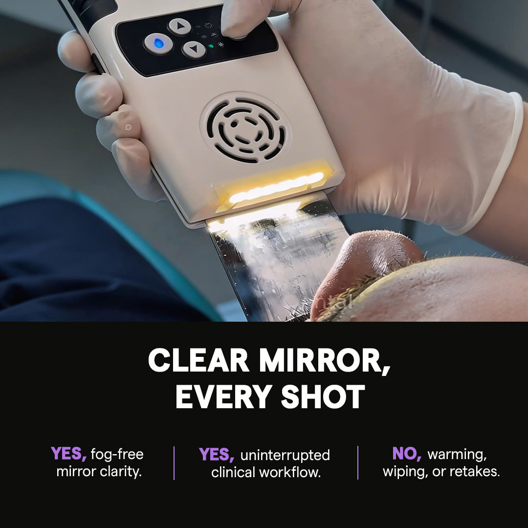 Anti Fog Mirror System Pro showing clear fog-free mirror during intraoral use