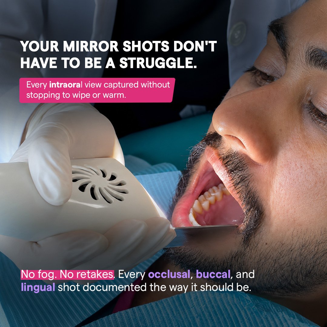 Anti-Fog Mirror System clear intraoral views without wiping