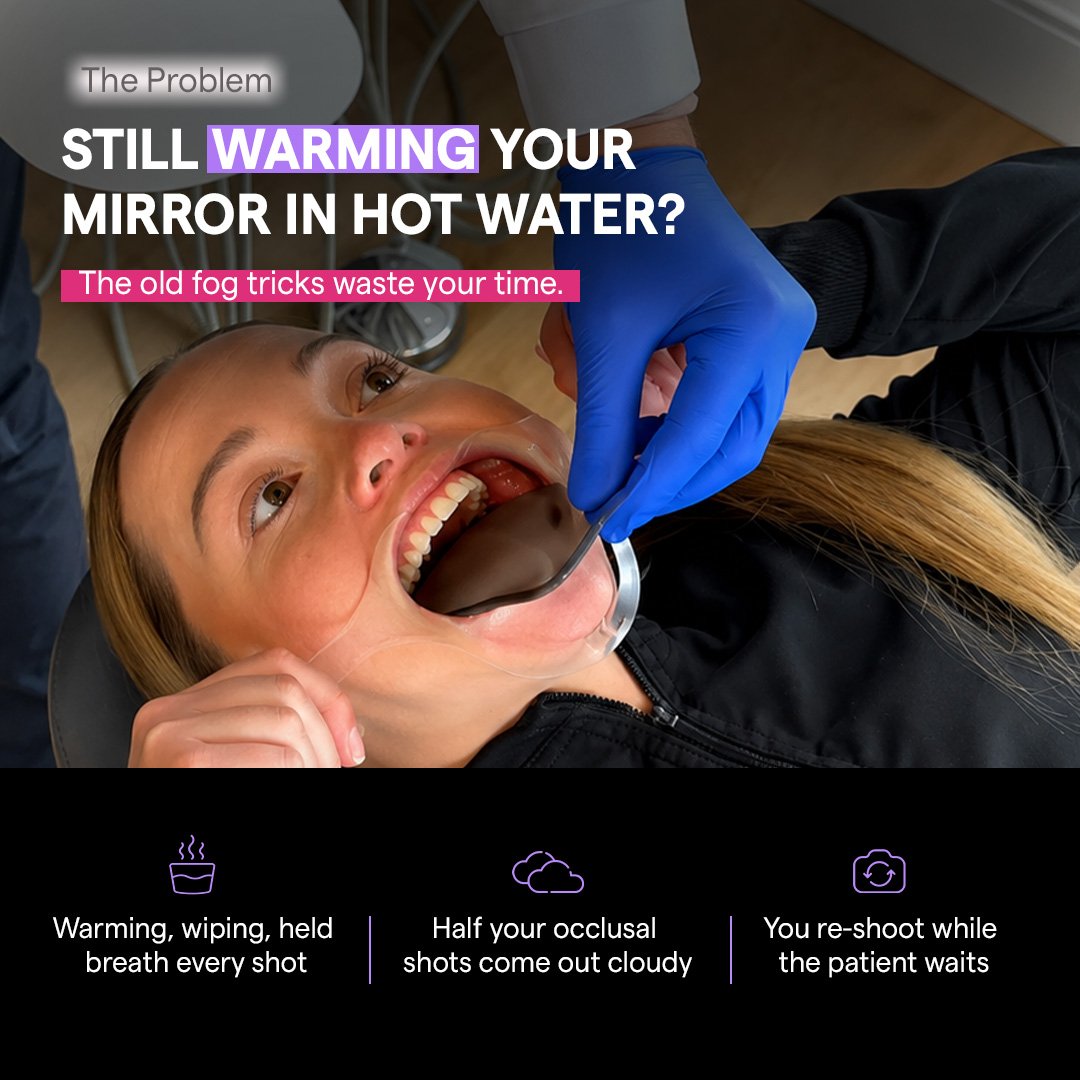 Traditional dental mirror fogging during intraoral photography