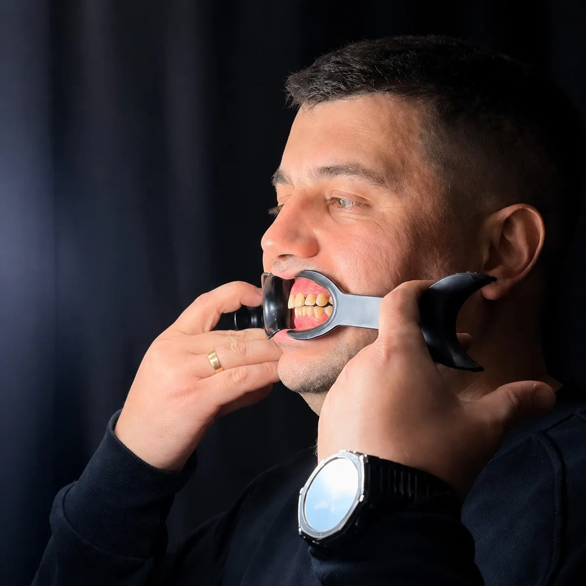 Patient wearing a retractor for dental photography.