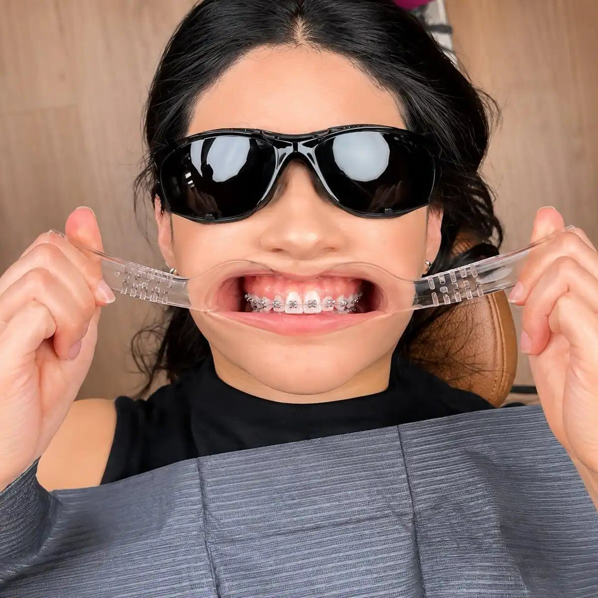 Patient with a retractor showing braces for dental photography.