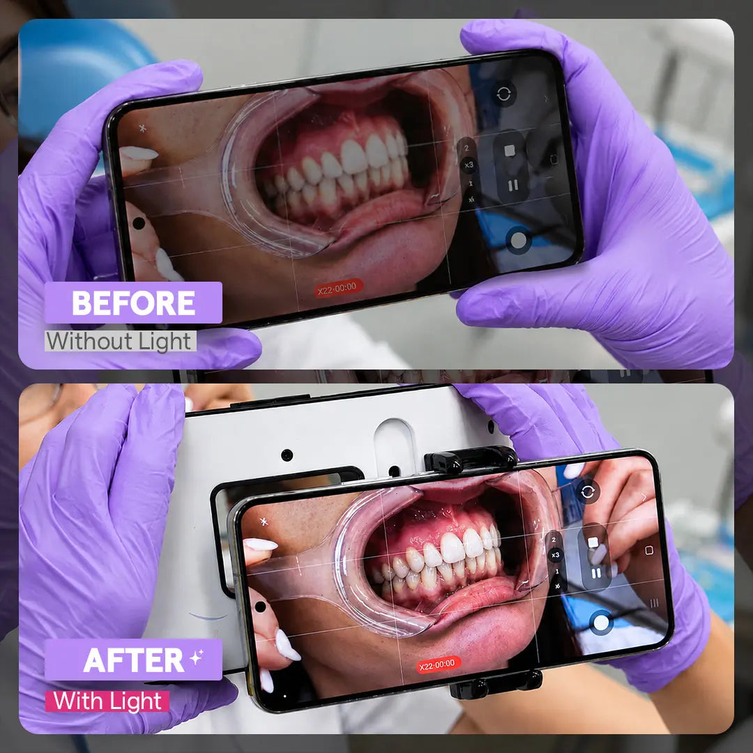Before and after comparison of a dental photo taken without and with the Dental Photography Light