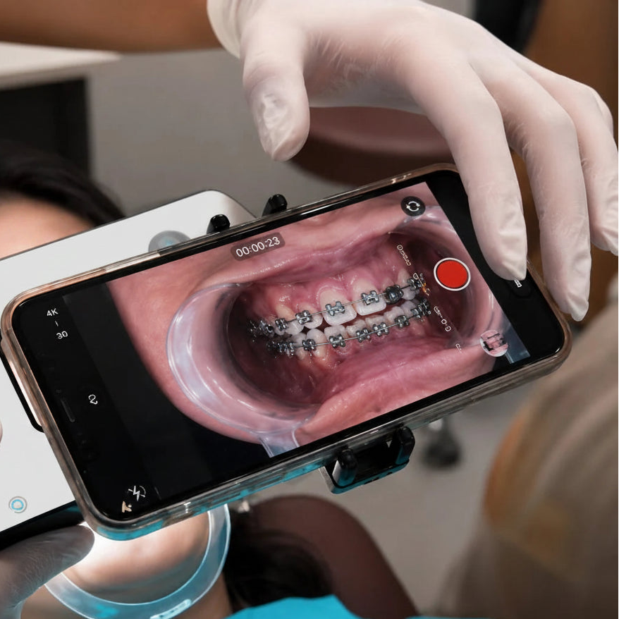 Braces photo taken with dental photography light