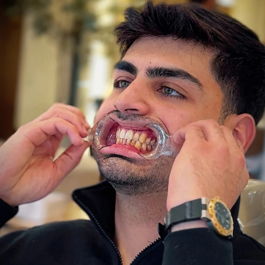 Patient with retractor for dental photography light