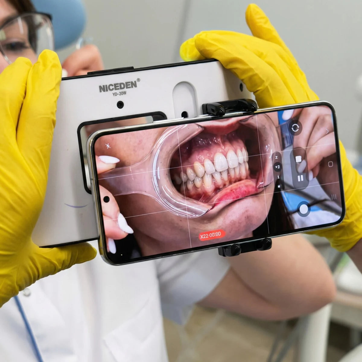 Full arch intraoral photo with dental photography light