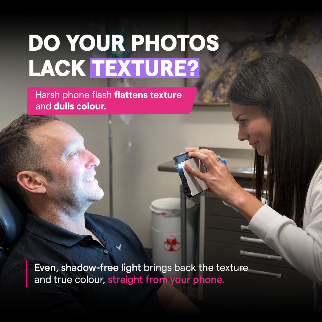 Shadow-free dental photo with Dental Photography Light