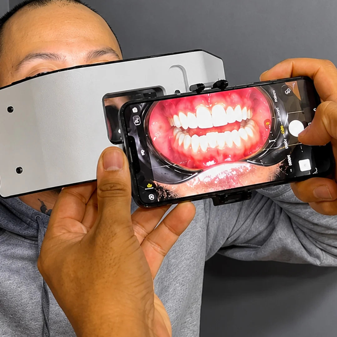 Smartphone dental photography light intraoral photo