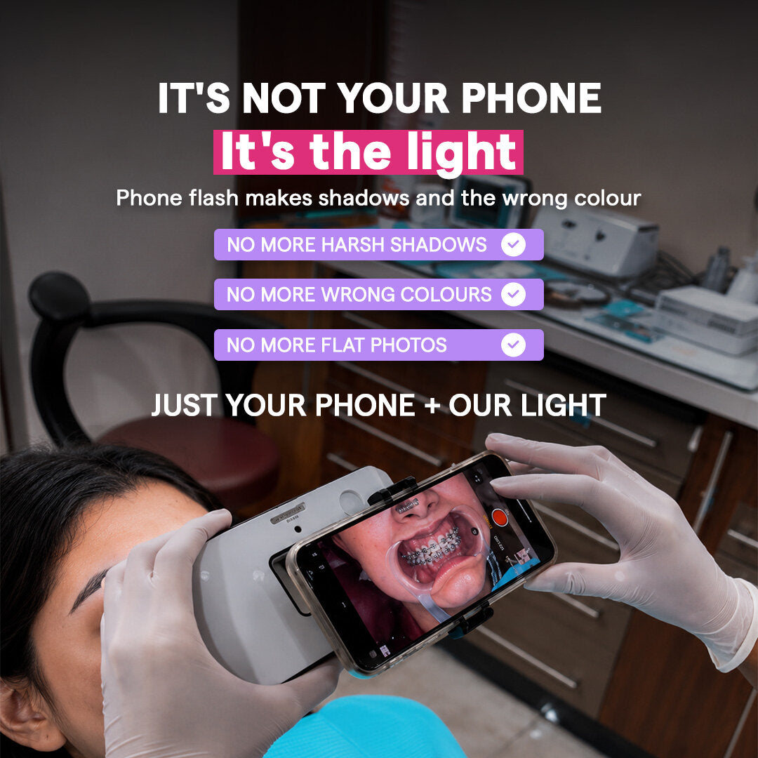 Dental Photography Light on smartphone, no harsh shadows