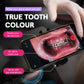 True tooth colour intraoral photo with Dental Photography Light