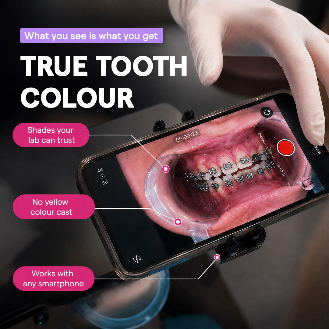 True tooth colour intraoral photo with Dental Photography Light