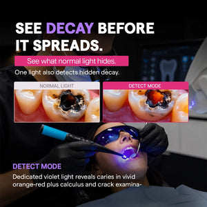 Caries detection normal light versus detect mode showing hidden decay in orange