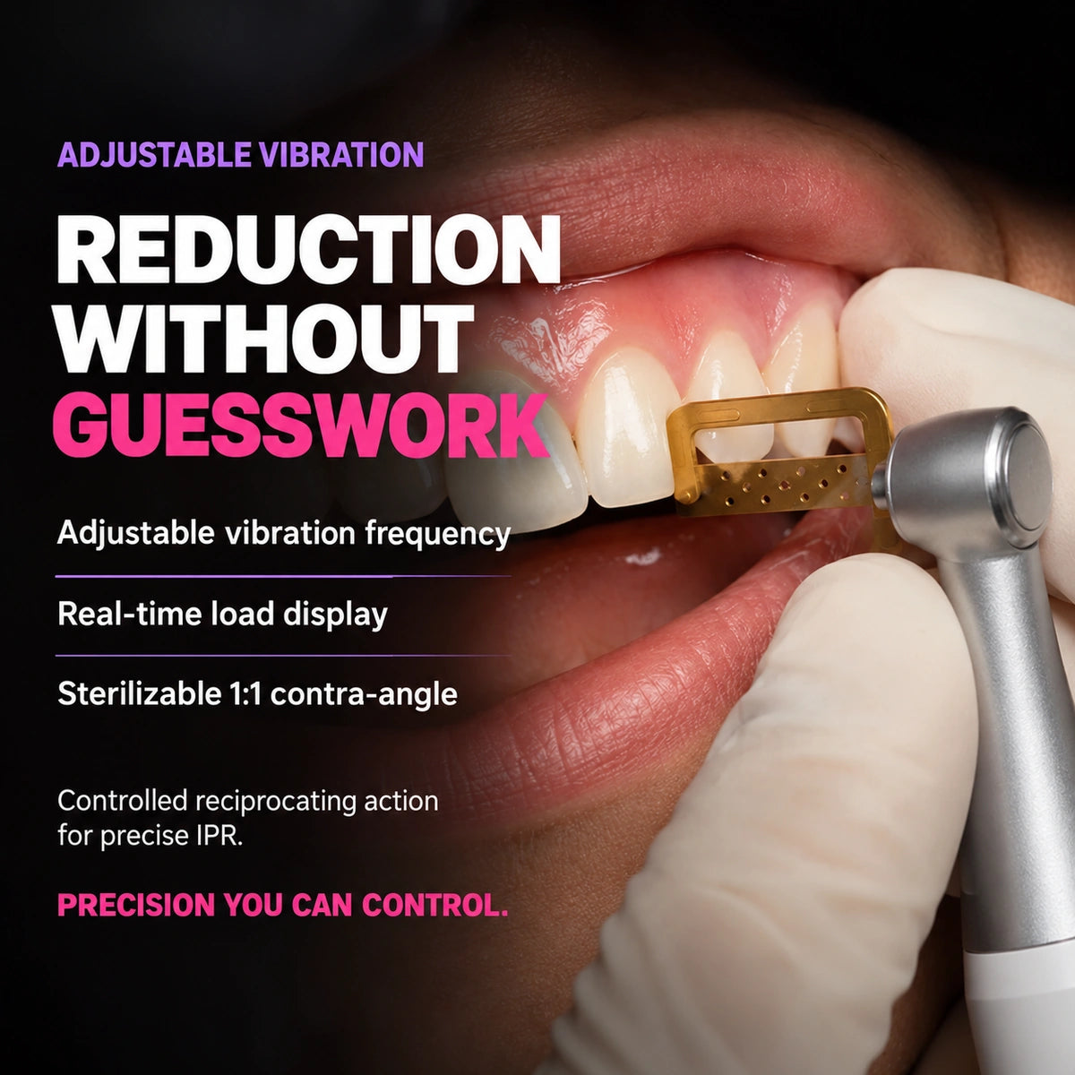 IPR motor with diamond strip reducing interproximal enamel on patient