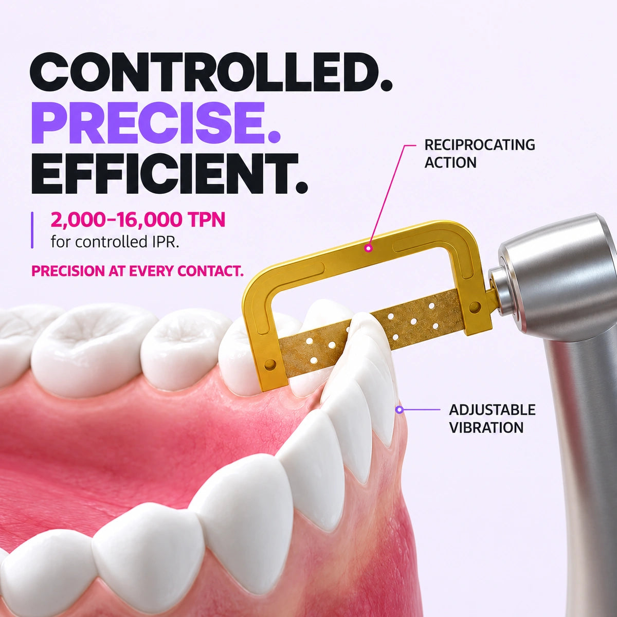 IPR motor with gold diamond strip reciprocating between teeth on jaw model