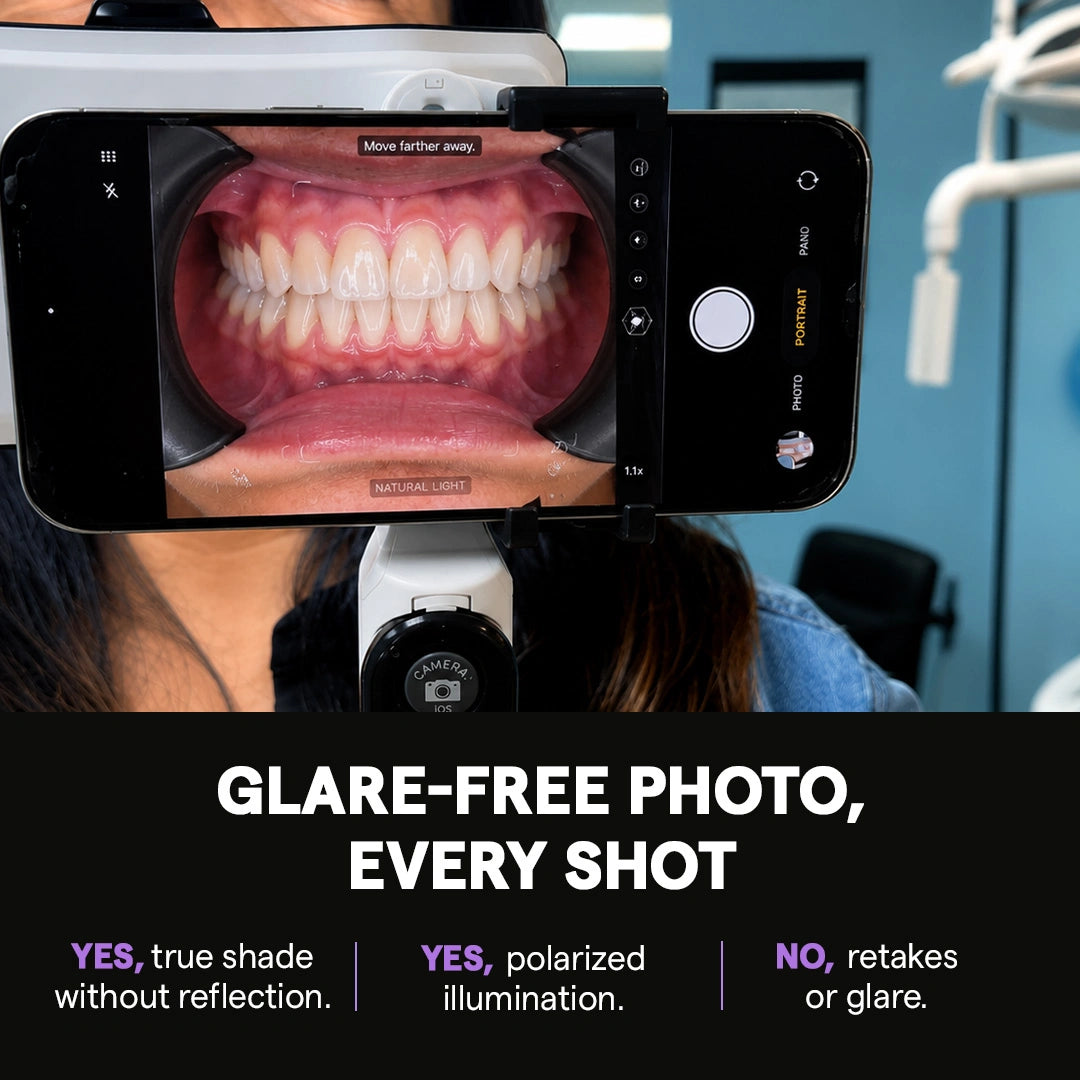 Glare-free polarized intraoral dental photo on smartphone screen.
