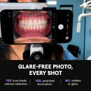 Glare-free polarized intraoral dental photo on smartphone screen.