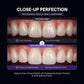 Dental close-up comparison without lens vs with macro lens 100mm.