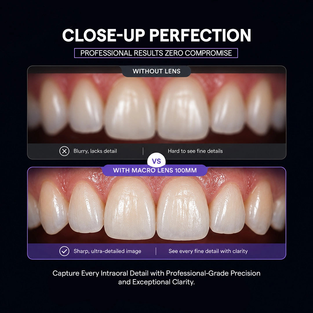 Dental close-up comparison without lens vs with macro lens 100mm.
