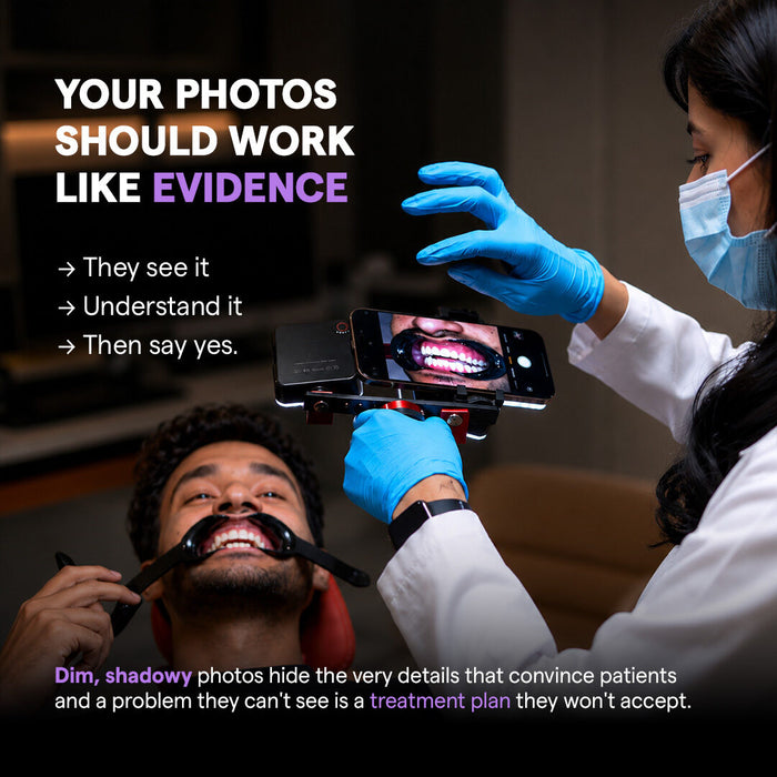 Twin Light Mobile Dental Photography kit