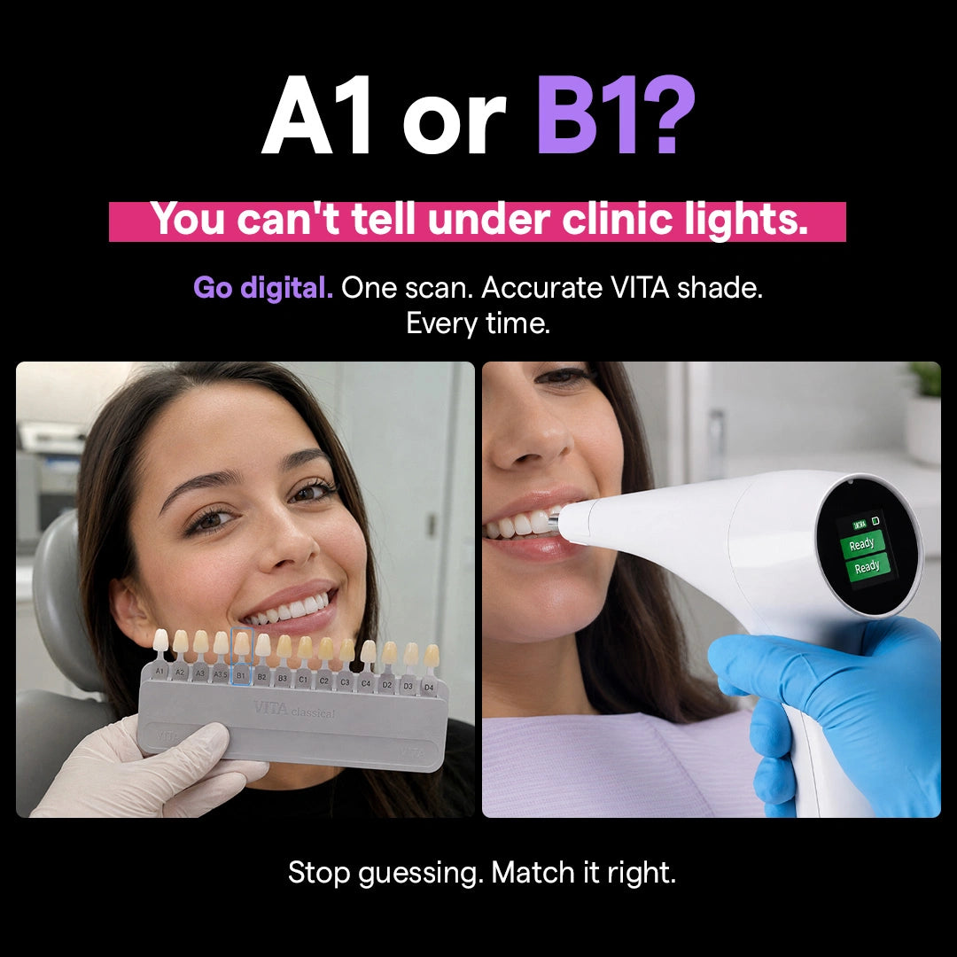 VITA shade guide vs digital dental shade matching device
