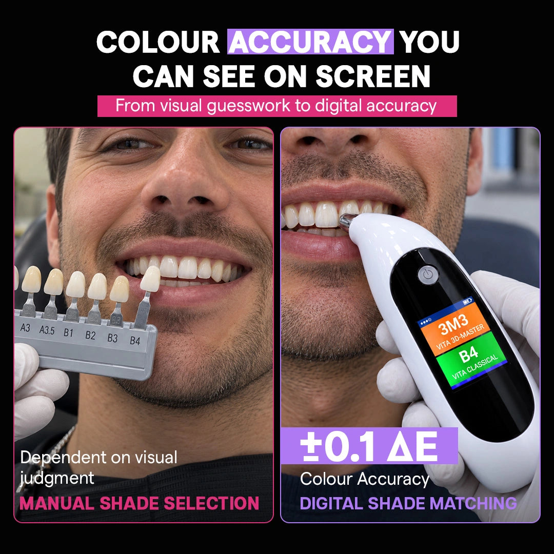 manual shade guide vs digital shade matching comparison
