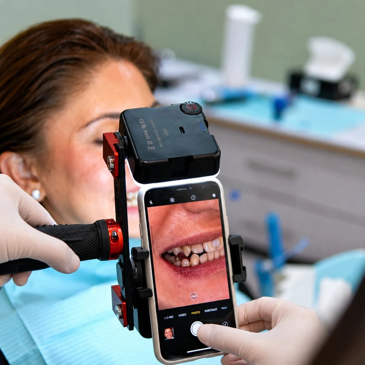 Dental photo taken with Twin Light on iPhone