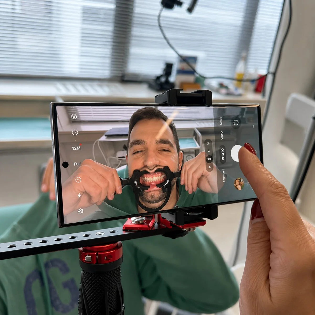 Dental photography with Twin Light and retractor
