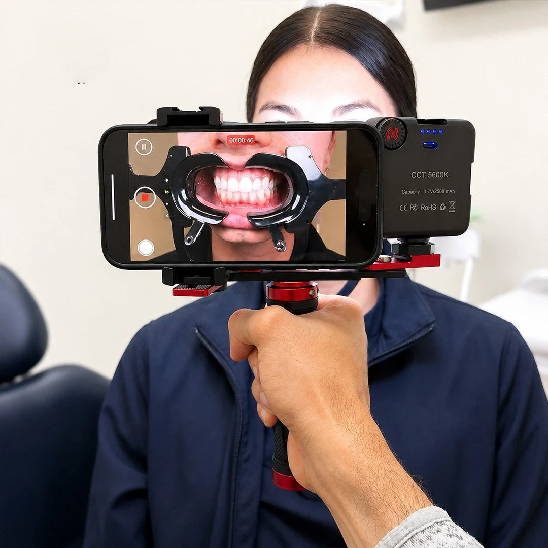 Intraoral photography with Twin Light on smartphone