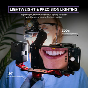 Twin Light For Mobile Dental Photography