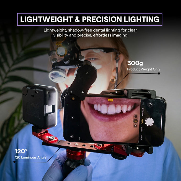 Twin Light For Mobile Dental Photography